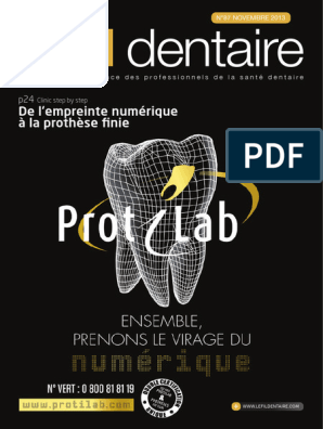 5 MARQUES DE FRAISES TRANS-MÉTAL - LEFILDENTAIRE magazine dentaire