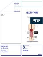 Cirurgia - Jejunostomia - HCC - Maio 2021