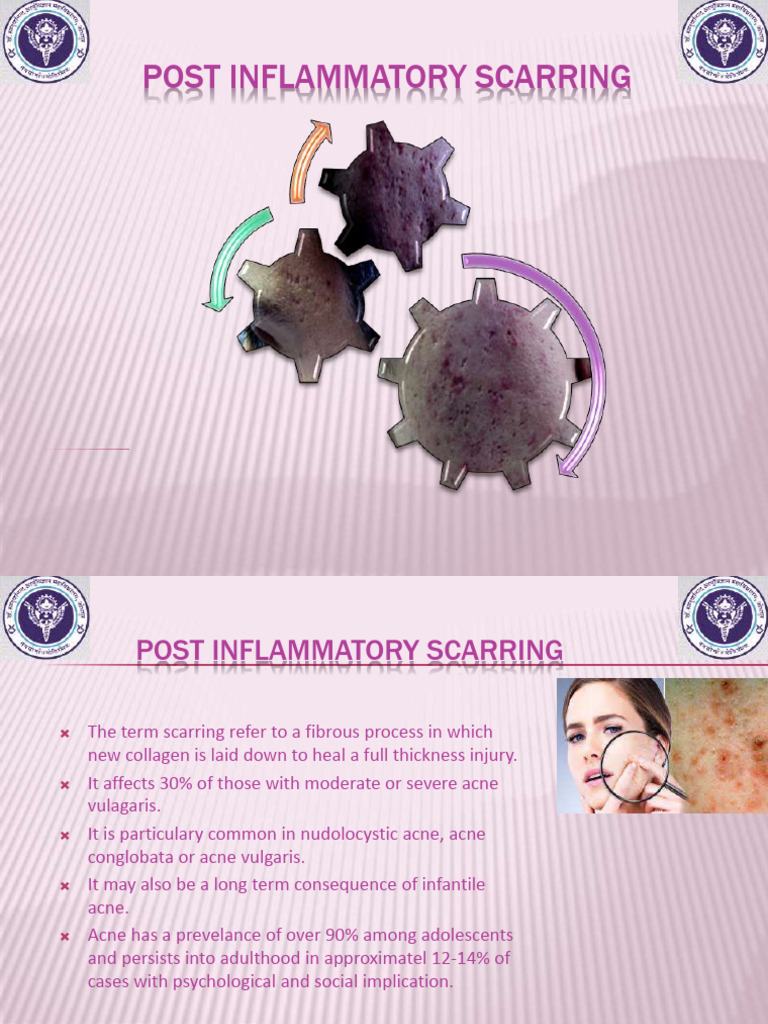 Understanding Post-Inflammatory Scarring | PDF