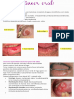 Carcinomas_231123_213858