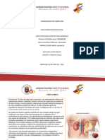 Caso Clinico Carcinoma Renal