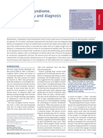 Cracked Tooth Syndrome. Part 1 Aetiology and Diagnosis