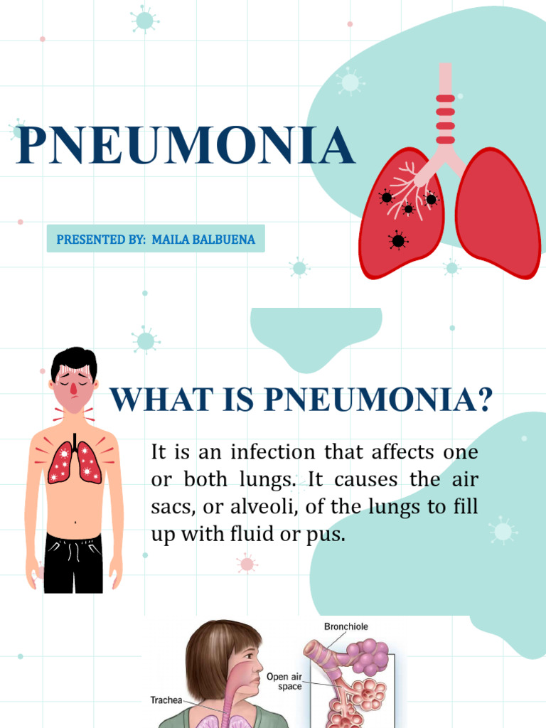 Pneumoniams Report | PDF