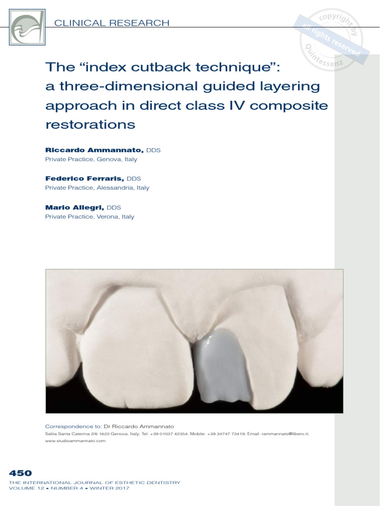 The "Index Cutback Technique" A ThreeDimensional Guided Layering