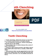 Teeth Clenching: For More Details Visit