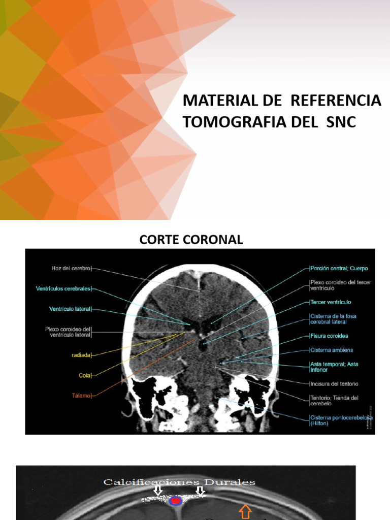 MATERIAL DE REFERENCIA TOMOGRAFIA DEL SNC | PDF