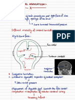 Cerebral herniation_230716_091801 (1)