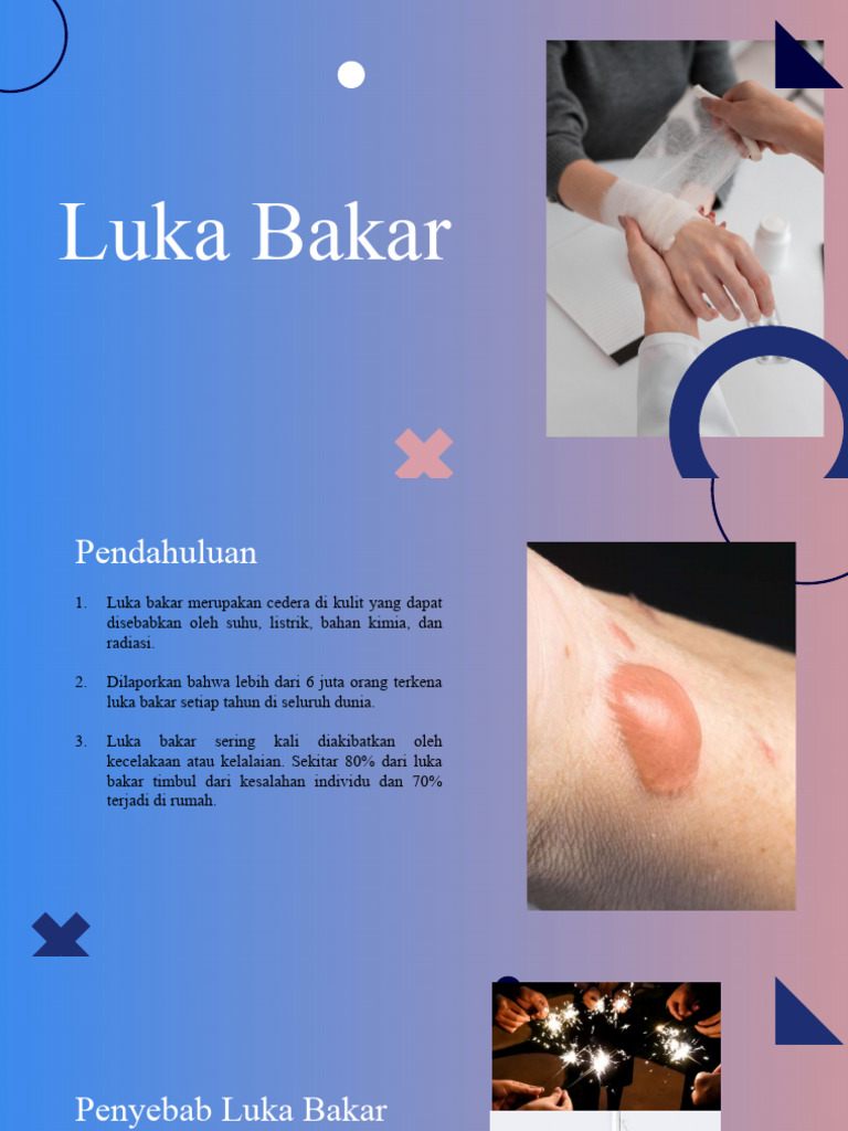 Slide Combutio | PDF