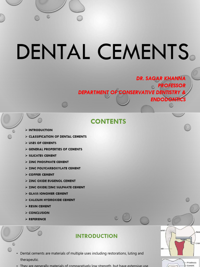 Dental Cements PDF