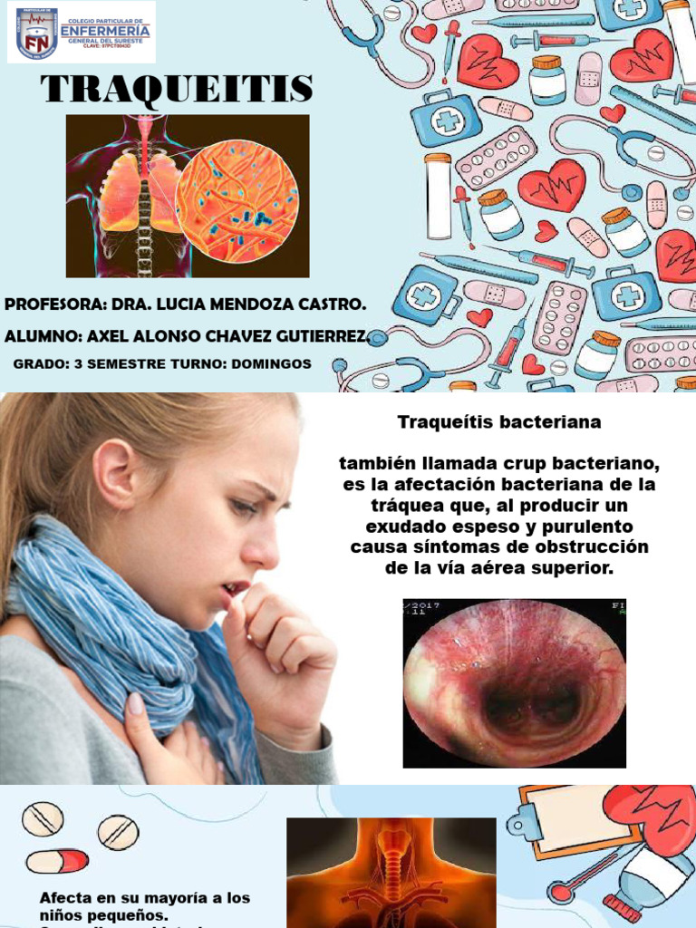 TRAQUEITIS 1 | PDF