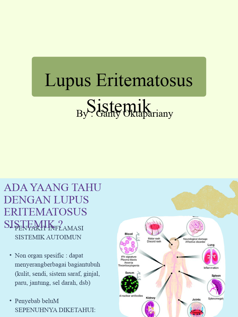 Lupus eritematosus sistemik pdf