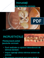 Curs 7 Incrustatii MD Tehnologia Protezelor Dentare Fixe 2