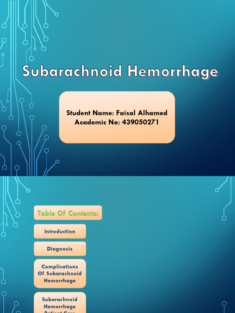 Subarachnoid Hemorrhage PDF Headache Nervous System