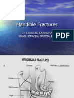 Mandible Fractures