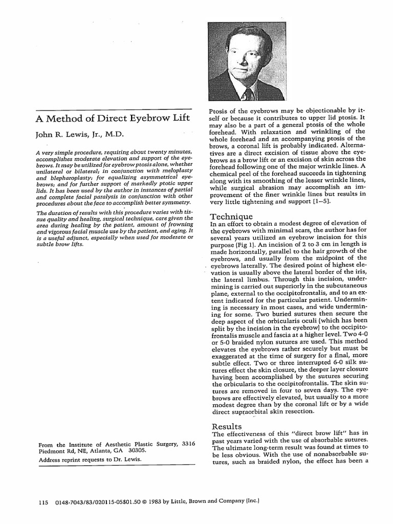 a-method-of-direct-eyebrow-lift-pdf