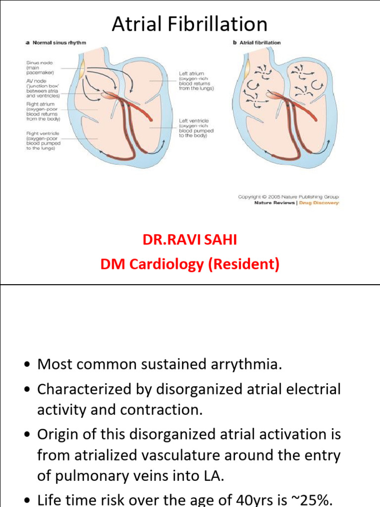 Atrial Fibrillation | PDF | Stroke | Diseases And Disorders