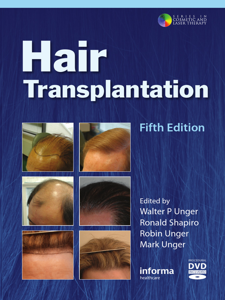 Hair Transplantation Fifth Edition（洋書） Hair Transplantation-Informa Healthcare 5th Ed. (2011) | PDF