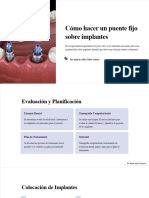 Como Hacer Un Puente Fijo Sobre Implantes