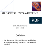 Grossesse Extra-Utérine (PR MERROUCHE)