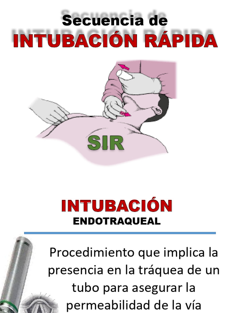 Secuencia de Intubación Rápida SIR | PDF | Lesión cerebral traumática ...