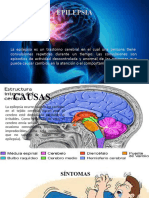 Epilepsia (1)