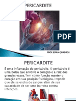 PERICARDITE