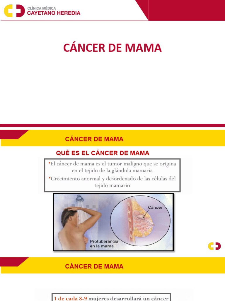 CANCER DE MAMA - JHH | PDF