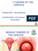 Benign Tumor of The Cervix