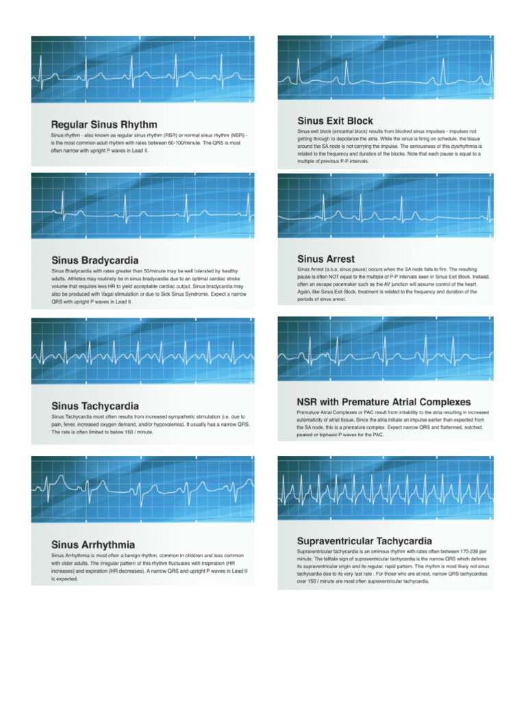 ECG | PDF
