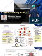 Cardiopatía Isquémica