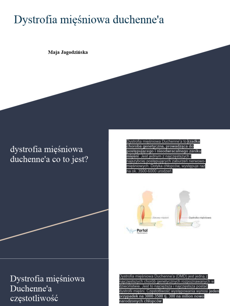 Dystrofia Mięśniowa Duchenne A Jest Nieuleczalna Choroba Genetyczna Kopia Dystrofia Mięśniowa Duchenne'A | PDF