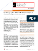 Spontanoues Rupture of The Renal Pelvis Presenting As An Urinoma in Locally Advanced Rectal Cancer