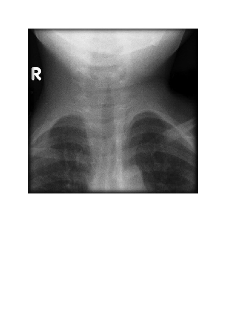 airway xray PDF
