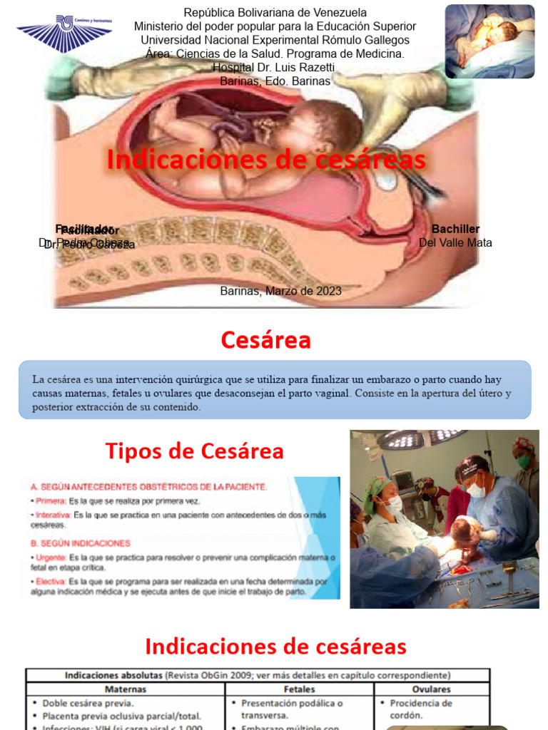 Indicaciones Cesarea | PDF