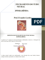 DTN Doenças Do Tubo Neural