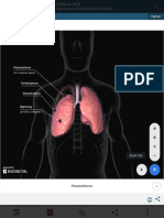 Pneumotórax - Distúrbios Pulmonares - Manuais MSD Edição para Profissionais