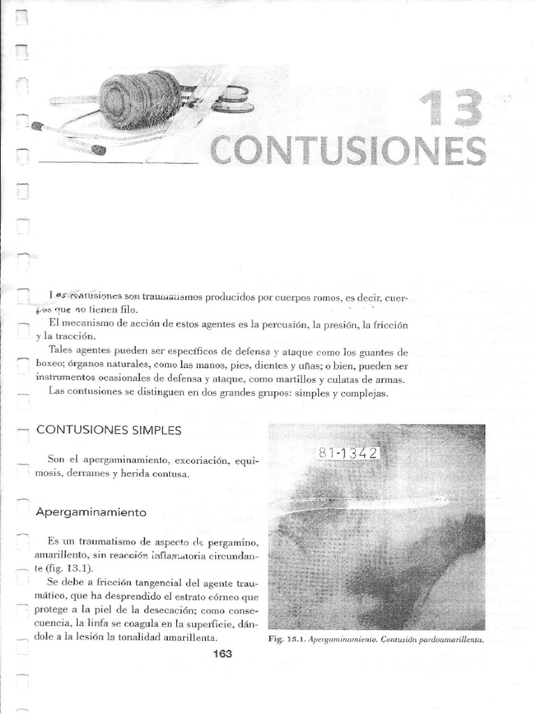 Contusion Es | PDF
