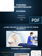 Gliomas PPT Paul Guerra