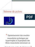 Stenose de Pylore