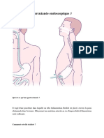 Gastrostomie Percutanée Endoscopique GPE
