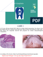 Week (15) Oral Dysplasia Malignancy