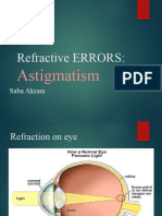 Refractive ERRORS (Astigmatism)