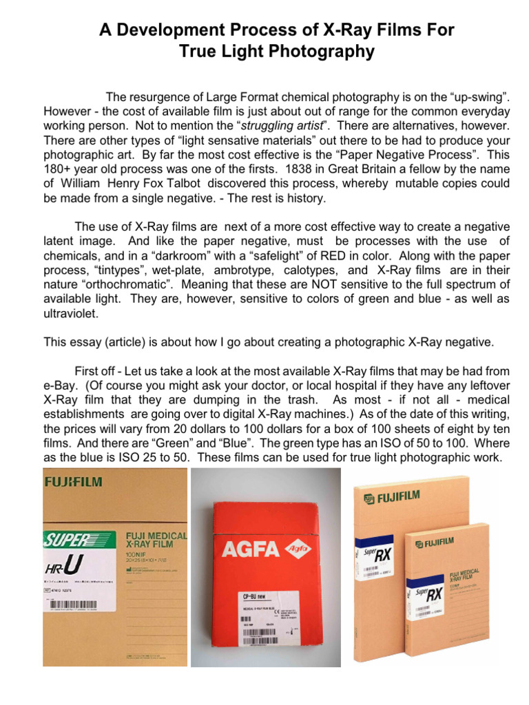 My Development of X-Ray Films | PDF | Image Scanner | Imaging