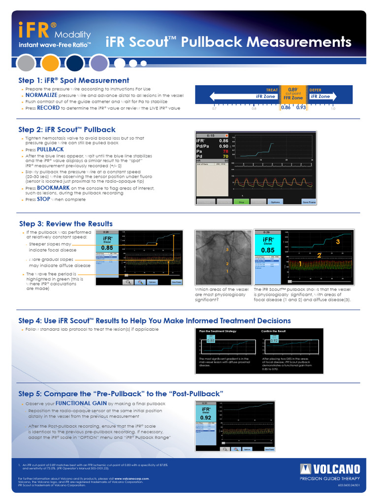 IFR Scout Measurement Steps PDF Clinical Medicine Medical Specialties