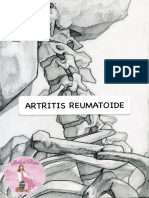 Artritis Reumatoide