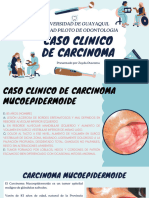 Carcinoma