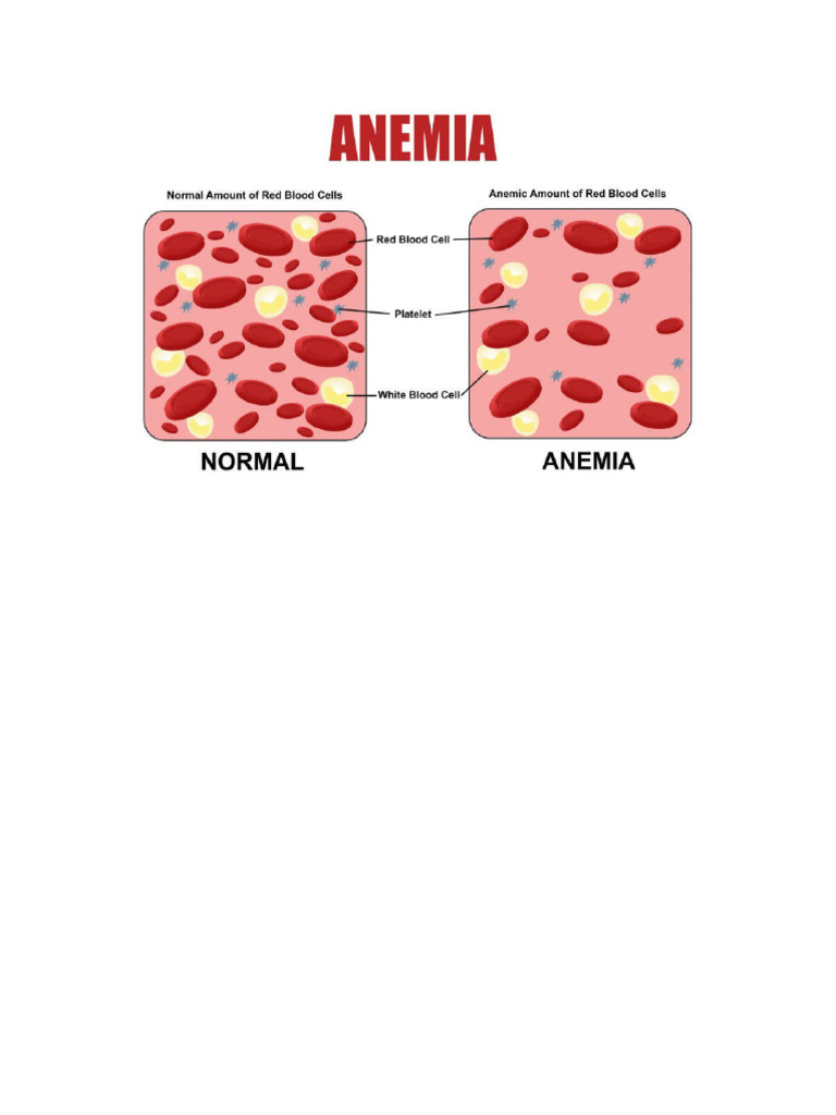 ANEMIA | PDF