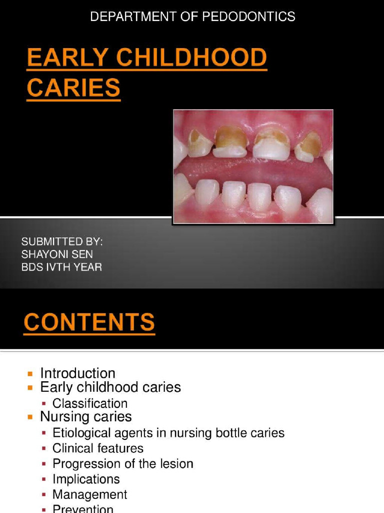 Early Childhood Caries 30474860 | PDF