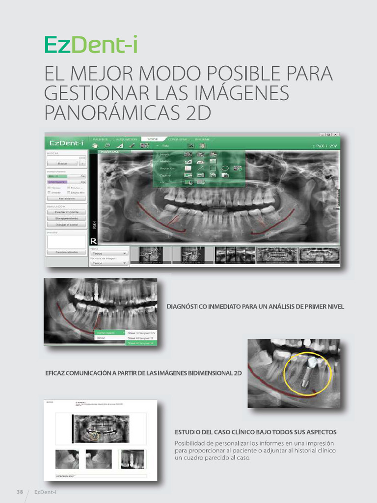 EzDent I Catalogo PDF