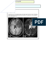 T2 Weighted Image MRI